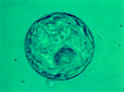 5日目移植胚(胚盤胞)