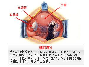 症状