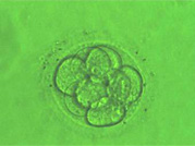 3日目移植胚(8細胞期)