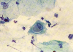 クラミジア感染細胞